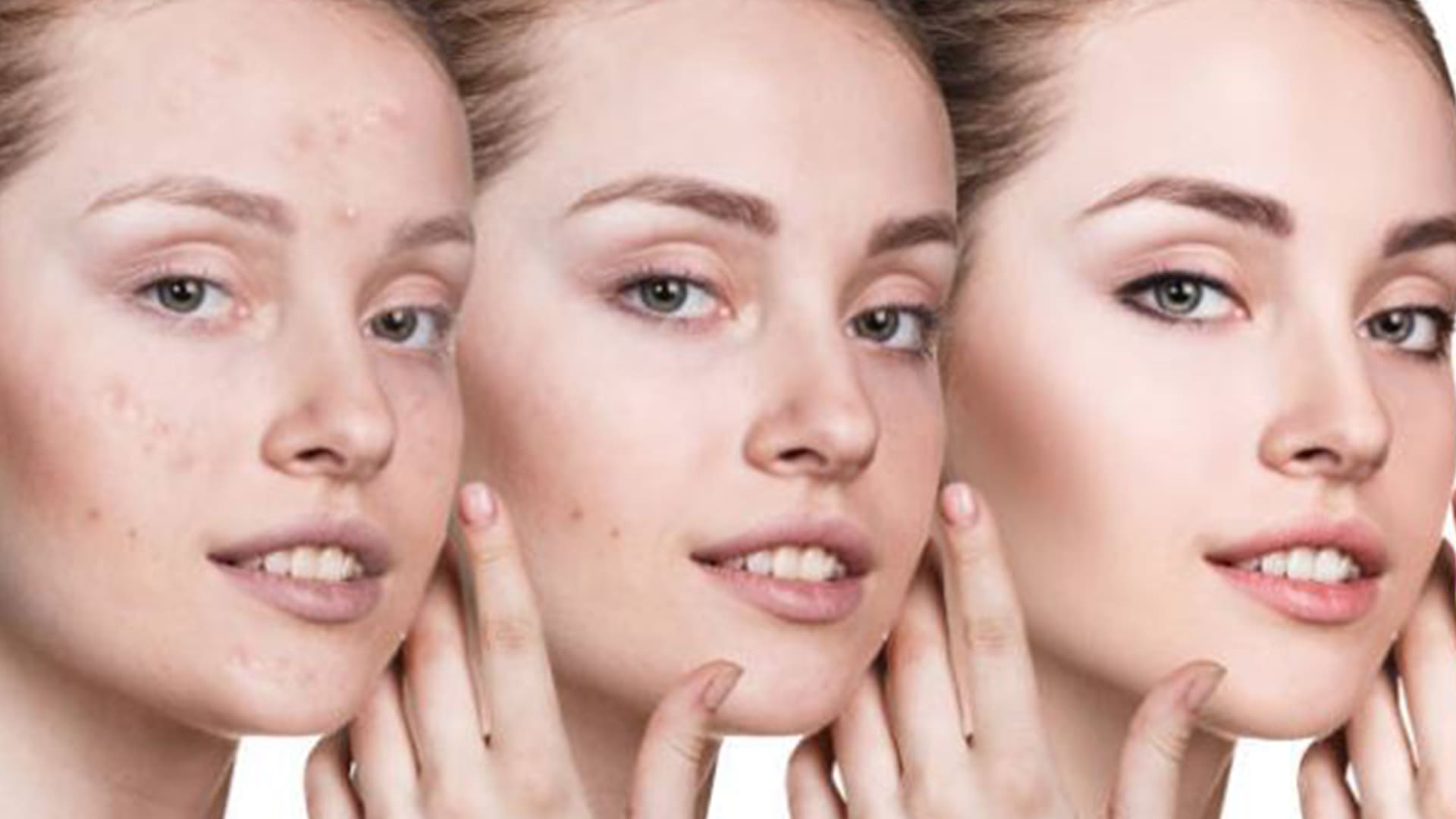 Maestría en dermatología estética